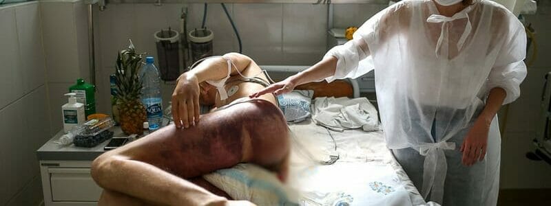 Lukashenko: photos of injuries are staged